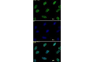 Histone H3 dimethyl Lys9 antibody tested by immunofluorescence. (Histone 3 Antikörper  (2meLys9))