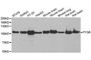 Western blot analysis of extracts of various cell lines, using PYGB antibody. (PYGB Antikörper)