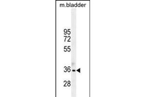 TGIF1 Antibody (Center ) (ABIN655999 and ABIN2845378) western blot analysis in mouse bladder tissue lysates (35 μg/lane). (TGIF1 Antikörper  (AA 208-237))