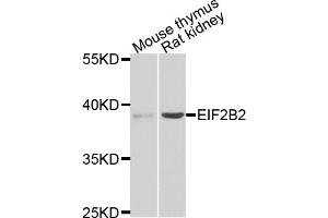 Western blot analysis of extracts of various cell lines, using EIF2B2 antibody (ABIN5975464) at 1/1000 dilution. (EIF2B2 Antikörper)