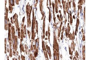 ABIN6266853 at 1/100 staining human Heart muscle tissue sections by IHC-P. (Transglutaminase 2 Antikörper  (N-Term))