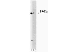 Western blot analysis of Neurotensin Receptor 3 on a PFSK-1 cell lysate (Human neuroectodermal tumor line, ATCC CRL-2060). (Sortilin 1 Antikörper  (AA 300-422))