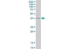 IL12B polyclonal antibody (A01), Lot # 050912JC01. (IL12B Antikörper  (AA 229-328))