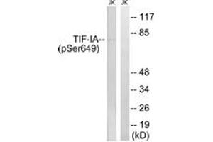 Western blot analysis of extracts from Jurkat cells treated with starved 24h, using TIF-IA (Phospho-Ser649) Antibody. (RRN3 Antikörper  (pSer649))