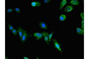Immunofluorescent analysis of Hela cells using ABIN7163601 at dilution of 1:100 and Alexa Fluor 488-congugated AffiniPure Goat Anti-Rabbit IgG(H+L) (PAFAH1B1 Antikörper  (AA 40-155))