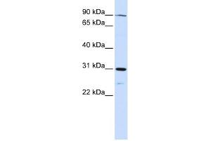 LONRF3 antibody used at 1 ug/ml to detect target protein. (LONRF3 Antikörper  (N-Term))