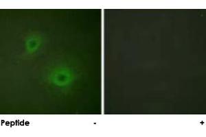 Immunofluorescence analysis of HUVEC cells, using EPHB1/EPHA2 polyclonal antibody . (EPH Receptor B1 Antikörper)