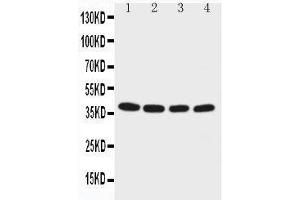 Anti-EIF2S2 antibody, Western blotting Lane 1: M451 Cell Lysate Lane 2: JURKAT Cell Lysate Lane 3: HELA Cell Lysate Lane 4:293T Cell Lysate (EIF2S2 Antikörper  (C-Term))