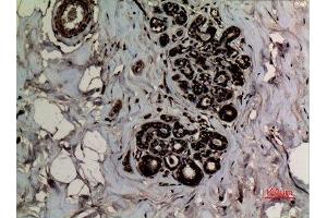 Immunohistochemistry (IHC) analysis of paraffin-embedded Human Breast, antibody was diluted at 1:100. (p53 Antikörper  (2meLys370))