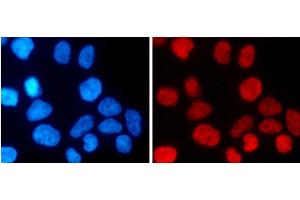 Immunofluorescence analysis of 293T cells using MonoMethyl-Histone H3-K27 Polyclonal Antibody (Histone 3 Antikörper  (meLys27))
