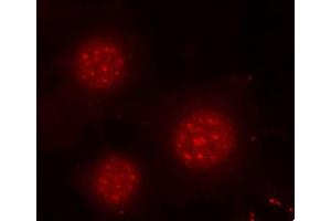 Immunofluorescence staining of methanol-fixed MCF-7 cells using Phospho-FOXO4-S197 antibody (ABIN2987524). (FOXO4 Antikörper  (pSer197))