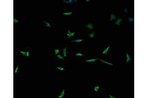 Immunofluorescence staining of SH-SY5Y cells with ABIN7173488 at 1:100, counter-stained with DAPI. (Tpp2 Antikörper  (AA 1-300))