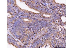 IHC analysis of Eg5/KIF11 using anti-Eg5/KIF11 antibody (ABIN7600277).