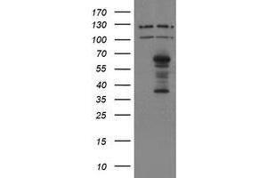 Image no. 1 for anti-SUMO1/sentrin/SMT3 Specific Peptidase 2 (SENP2) (AA 139-523) antibody (ABIN1490928) (SENP2 Antikörper  (AA 139-523))