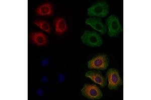 ABIN6261629 and ABIN6278037 staining Hela cells by IF/ICC.