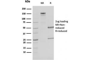 SDS-PAGE Analysis Purified MDH1 Mouse Monoclonal Antibody (CPTC-MDH1-1). (MDH1 Antikörper)