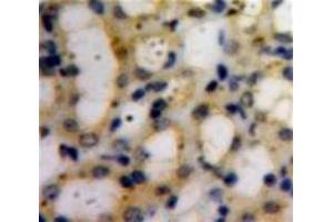 Used in DAB staining on fromalin fixed paraffin-embedded Kidney tissue (COL6A1 Antikörper  (AA 828-1022))
