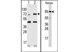 Image no. 1 for anti-Ribosomal Protein S6 Kinase, 90kDa, Polypeptide 3 (RPS6KA3) (N-Term) antibody (ABIN360345)