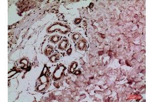 Immunohistochemistry (IHC) analysis of paraffin-embedded Human Skin, antibody was diluted at 1:100. (IL-1 beta Antikörper  (Internal Region))