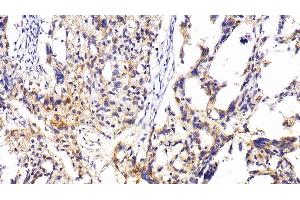 Immunohistochemistry (IHC) image for anti-Eosinophil Cationic Protein (ECP) (AA 30-154) antibody (ABIN7434023)
