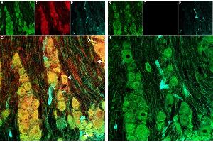 Expression of GsMTx-4-Biotin in Rat DRG Frozen Sections. (GsMTx-4 peptide (Biotin))