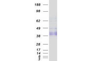 Validation with Western Blot
