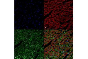 Immunohistochemistry analysis using Mouse Anti-Hexanoyl-Lysine adduct Monoclonal Antibody, Clone 5D9 (ABIN5067237). (Hexanoyl-Lysine Adduct (HEL) Antikörper (Atto 488))