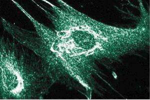 Immunofluorescence staining of human intestinal smooth muscle cells (HISM). (ANKS1B Antikörper  (AA 107-268))