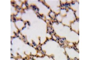 Used in DAB staining on fromalin fixed paraffin-embedded Lung tissue (SH2D1A Antikörper  (AA 18-115))
