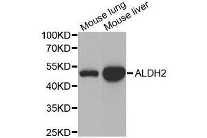 Western blot analysis of extracts of various cell lines, using ALDH2 antibody.