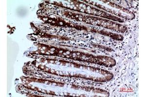 Immunohistochemical analysis of paraffin-embedded human-colon, antibody was diluted at 1:100. (FOXP3 Antikörper  (C-Term))
