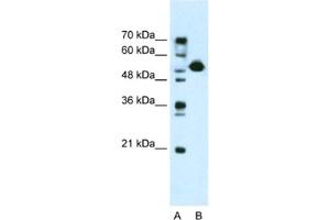 Western Blotting (WB) image for anti-DKFZP781I1119 antibody (ABIN2461018) (DKFZP781I1119 Antikörper)