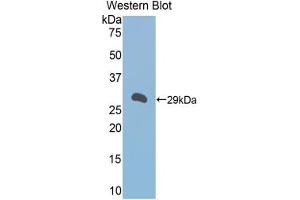 Western blot analysis of the recombinant protein. (A1BG Antikörper  (AA 22-219))