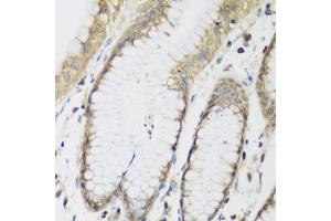 Immunohistochemistry of paraffin-embedded human stomach using METTL7A antibody. (METTL7A Antikörper)