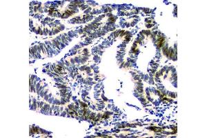 IHC analysis of NFIA using anti-NFIA antibody (ABIN6719349). (NFIA Antikörper  (Middle Region))