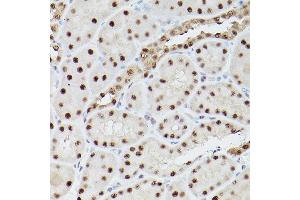 Immunohistochemistry of paraffin-embedded rat kidney using PSME3 Rabbit pAb (ABIN6135015, ABIN6146357, ABIN6146358 and ABIN6216428) at dilution of 1:100 (40x lens). (PSME3 Antikörper  (C-Term))