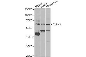 Western blot analysis of extracts of various cell lines, using DYRK2 antibody (ABIN5974219) at 1/1000 dilution. (DYRK2 Antikörper)