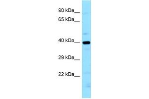 WB Suggested Anti-LIMS2 Antibody Titration: 1.