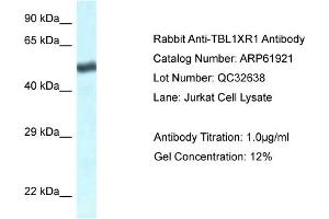 Western Blotting (WB) image for anti-Transducin (Beta)-Like 1 X-Linked Receptor 1 (TBL1XR1) (C-Term) antibody (ABIN2788949)