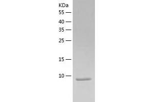 Western Blotting (WB) image for Chemokine (C-X-C Motif) Ligand 14 (CXCL14) (AA 35-111) protein (His tag) (ABIN7122331) (CXCL14 Protein (AA 35-111) (His tag))