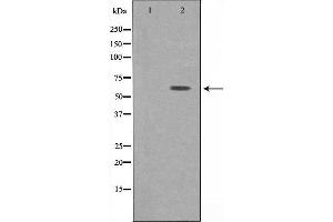 Western blot analysis of extracts from HepG2 cells, using ATP6V1B1 antibody. (ATP6V1B1 Antikörper  (Internal Region))