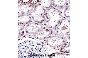 Immunohistochemistry (IHC) image for anti-Forkhead Box D1 (FOXD1) antibody (ABIN2997954) (FOXD1 Antikörper)