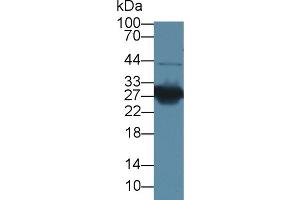 Western blot analysis of Mouse Kidney lysate, using Rabbit Anti-Mouse HMG1 Antibody (1 µg/ml) and HRP-conjugated Goat Anti-Rabbit antibody (abx400043, 0.
