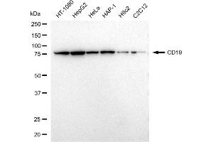 Western blotting analysis using CD19 antibody (ABIN7797954).
