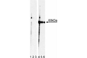 Western blot analysis of Akt (pT308). (AKT1 Antikörper  (pThr308))