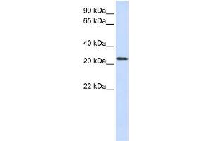 WB Suggested Anti-C21orf2  Antibody Titration: 0. (C21orf2 Antikörper  (N-Term))