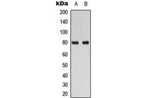 Western blot analysis of RAD17 expression in human Oral cancer (A), HuvEc (B) whole cell lysates. (RAD17 Antikörper  (C-Term))