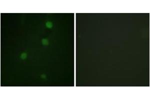 Immunofluorescence analysis of NIH-3T3 cells, using Retinoblastoma (Ab-821) Antibody. (Retinoblastoma Protein (Rb) Antikörper  (AA 791-840))