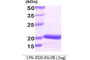 SDS-PAGE (SDS) image for Stathmin 1 (STMN1) (AA 1-149) protein (His tag) (ABIN667094) (Stathmin 1 Protein (STMN1) (AA 1-149) (His tag))
