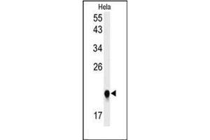 Western blot analysis of IMP3 Antibody (C-term) in Hela cell line lysates (35ug/lane). (IMP3 Antikörper  (C-Term))